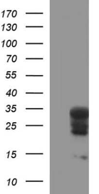 Western Blot: HSCB Antibody (OTI3E1) [NBP2-46506]