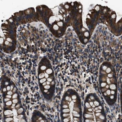 Immunohistochemistry-Paraffin: HSCB Antibody [NBP1-84066]