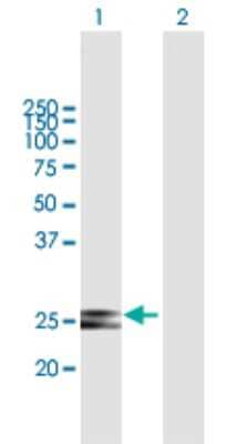 Western Blot: HSCB Antibody [H00150274-B01P]