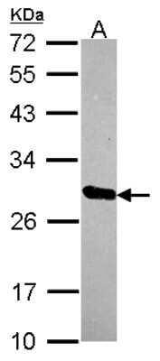 Western Blot: HSCB Antibody [NBP2-16883]