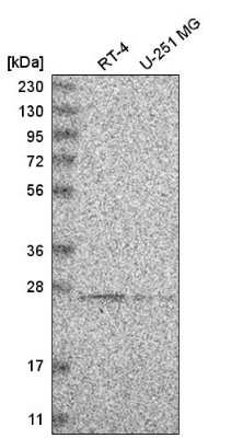 Western Blot: HSCB Antibody [NBP2-54997]