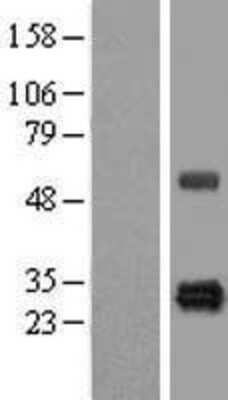 Western Blot: HSCB Overexpression Lysate [NBL1-11717]