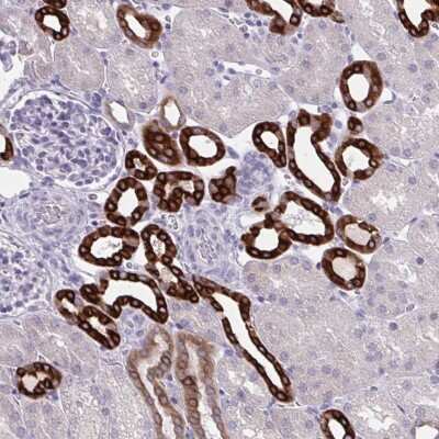 Immunohistochemistry-Paraffin: HSD11B2 Antibody [NBP2-37898]