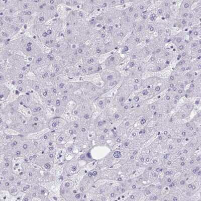 Immunohistochemistry-Paraffin: HSD11B2 Antibody [NBP2-37898]