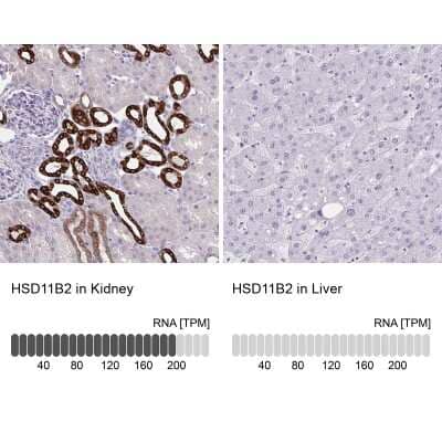 Immunohistochemistry-Paraffin: HSD11B2 Antibody [NBP2-37898]