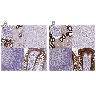 Immunohistochemistry-Paraffin: HSD11B2 Antibody [NBP2-37898]