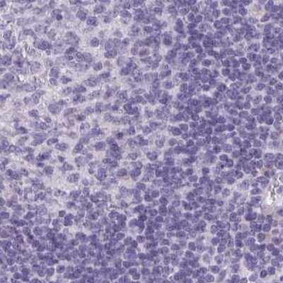 Immunohistochemistry-Paraffin: HSD11B2 Antibody [NBP2-37898]