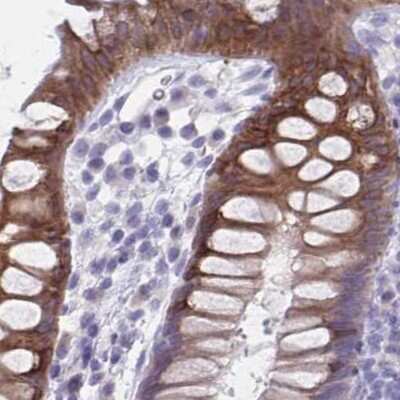 Immunohistochemistry-Paraffin: HSD11B2 Antibody [NBP2-37898]