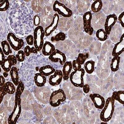 Immunohistochemistry-Paraffin: HSD11B2 Antibody [NBP2-37954]