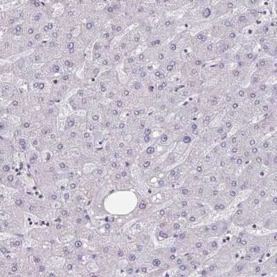 Immunohistochemistry-Paraffin: HSD11B2 Antibody [NBP2-37954]