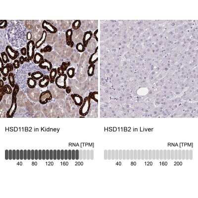 Immunohistochemistry-Paraffin: HSD11B2 Antibody [NBP2-37954]