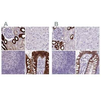 Immunohistochemistry-Paraffin: HSD11B2 Antibody [NBP2-37954]