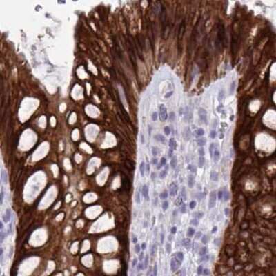 Immunohistochemistry-Paraffin: HSD11B2 Antibody [NBP2-37954]