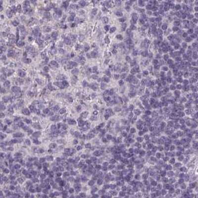 Immunohistochemistry-Paraffin: HSD11B2 Antibody [NBP2-37954]