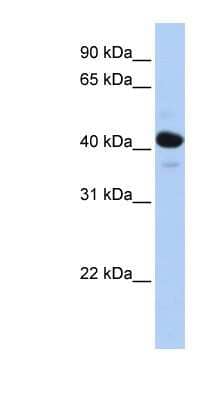 Western Blot: HSD11B2 Antibody [NBP1-53163]