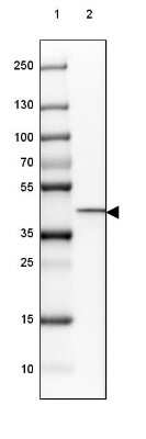 Western Blot: HSD11B2 Antibody [NBP2-37898]