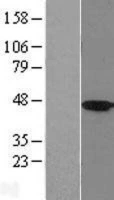 Western Blot: HSD11B2 Overexpression Lysate [NBL1-11721]