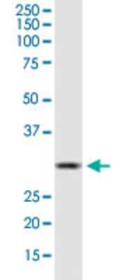 Western Blot: HSD17B12 Antibody (4G11) [H00051144-M08]