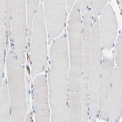 Immunohistochemistry-Paraffin: HSD17B12 Antibody [NBP1-81567]