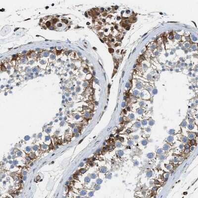Immunohistochemistry-Paraffin: HSD17B12 Antibody [NBP1-81567]