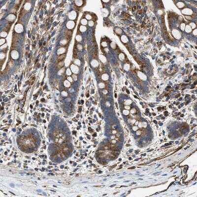 Immunohistochemistry-Paraffin: HSD17B12 Antibody [NBP1-81567]