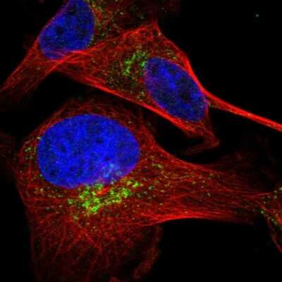 Immunocytochemistry/ Immunofluorescence: HSD17B13 Antibody [NBP1-90669]