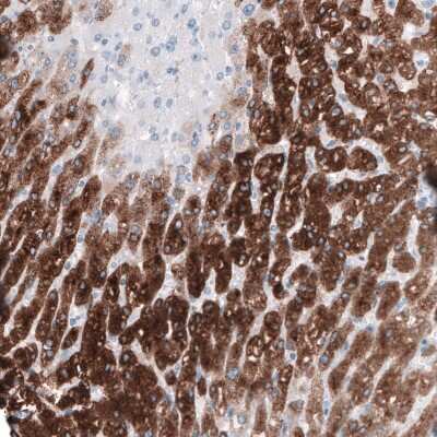 Immunohistochemistry-Paraffin: HSD17B13 Antibody [NBP1-90669]