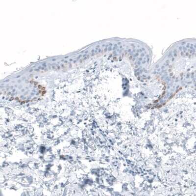 Immunohistochemistry-Paraffin: HSD17B13 Antibody [NBP1-90669]