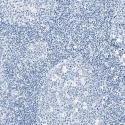 Immunohistochemistry-Paraffin: HSD17B13 Antibody [NBP1-90669]