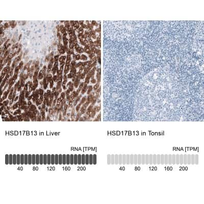 Immunohistochemistry-Paraffin: HSD17B13 Antibody [NBP1-90669]