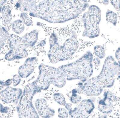 Immunohistochemistry-Paraffin: HSD17B13 Antibody [NBP1-90669]
