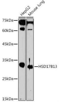 Western Blot: HSD17B13 AntibodyAzide and BSA Free [NBP3-04837]