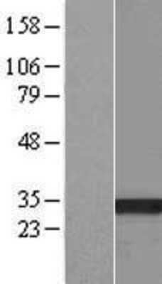 Western Blot: HSD17B13 Overexpression Lysate [NBP2-04969]