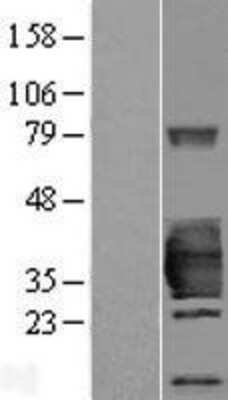 Western Blot: 17 beta-HSD14/HSD17B14 Overexpression Lysate [NBP2-07063]