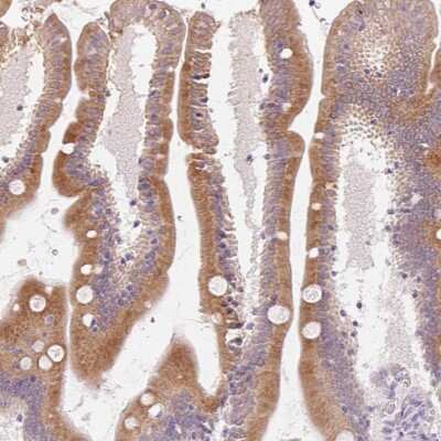 Immunohistochemistry: HSD17B2 Antibody [NBP2-48956]