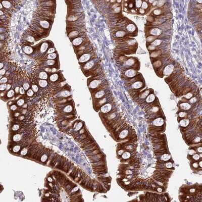 Immunohistochemistry-Paraffin: HSD17B2 Antibody [NBP1-92011]