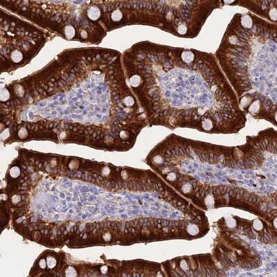 Immunohistochemistry-Paraffin: HSD17B2 Antibody [NBP1-92011]