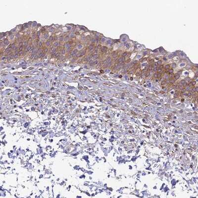 Immunohistochemistry-Paraffin: HSD17B2 Antibody [NBP1-92011]