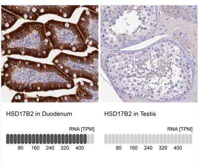 Immunohistochemistry-Paraffin: HSD17B2 Antibody [NBP1-92011]