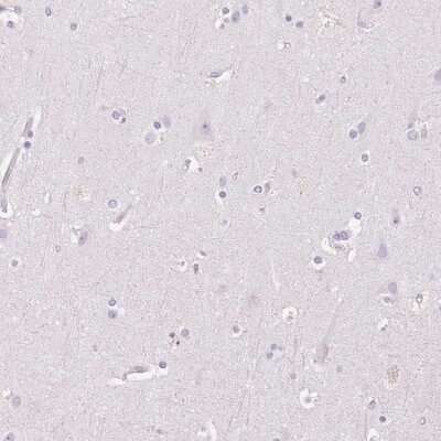 Immunohistochemistry-Paraffin: HSD17B2 Antibody [NBP2-48956]
