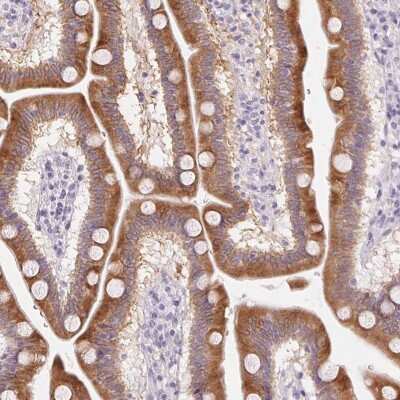 Immunohistochemistry-Paraffin: HSD17B2 Antibody [NBP2-48956]