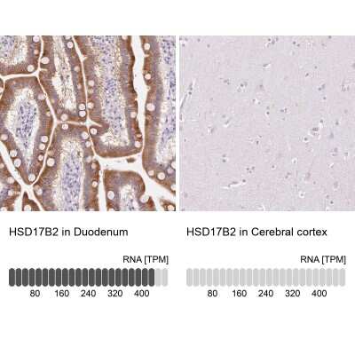 Immunohistochemistry-Paraffin: HSD17B2 Antibody [NBP2-48956]