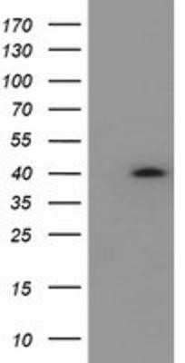 Western Blot: HSD17B2 Antibody (OTI4F10)Azide and BSA Free [NBP2-70945]