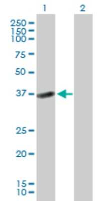 Western Blot: HSD17B2 Antibody [H00003294-B01P]