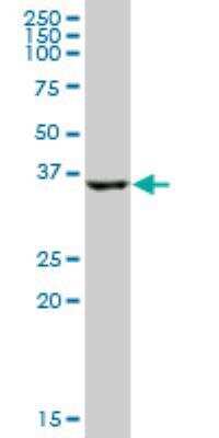 Western Blot: HSD17B2 Antibody [H00003294-B02P]