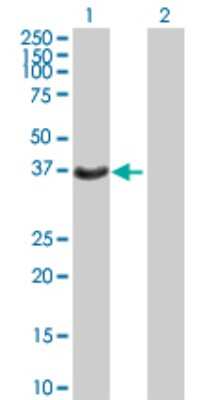 Western Blot: HSD17B2 Antibody [H00003294-B02P]