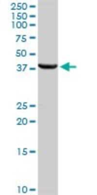 Western Blot: HSD17B2 Antibody [H00003294-D01P]