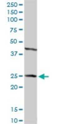 Western Blot: HSD17B2 Antibody [H00003294-D01P]