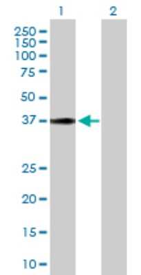 Western Blot: HSD17B2 Antibody [H00003294-D01P]