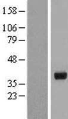 Western Blot: HSD17B2 Overexpression Lysate [NBL1-11726]